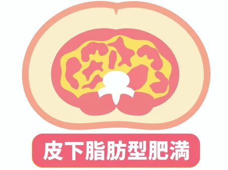 皮下脂肪型肥満の図解 皮下脂肪型肥満,人体,図解,皮下脂肪,内臓脂肪,肥満,脂肪,腹部,お腹,輪切りのイラスト素材