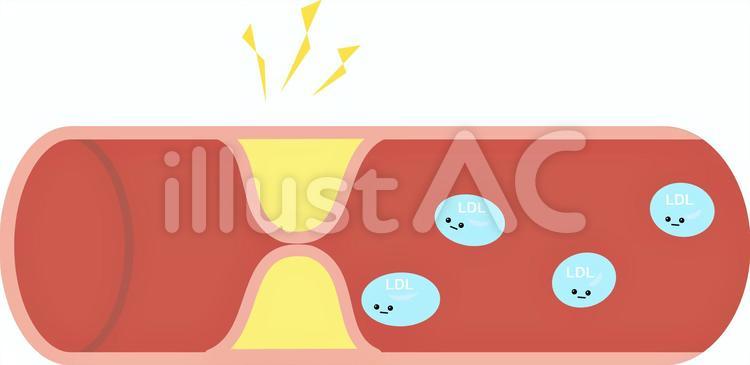 顔つき　血管 顔つき,血管,動脈のイラスト素材