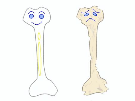 骨 ほね,強い,弱った,ボロボロ,健康,状態のイラスト素材