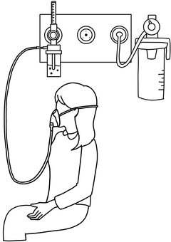中央配管から酸素マスクへ　女性線画 中央配管,酸素,マスク,患者,女性,病院,線画のイラスト素材