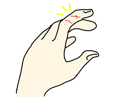 いつの間にかできる謎の傷 手,手指,指,傷,切り傷,擦り傷,あかぎれ,冬,乾燥,ハンドケアのイラスト素材