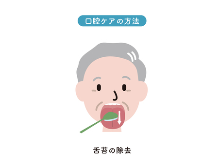 口腔ケア　舌苔の除去 口腔ケア,舌苔,歯科,医療・福祉,高齢者のイラスト素材