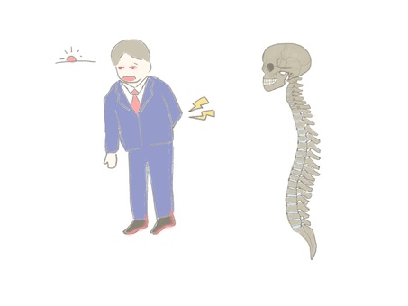 強直性脊椎炎 強直性脊椎炎,背骨,腰痛,脊柱,椎骨,仙腸関節炎,アキレス腱炎,足底腱膜炎,ぶどう膜炎のイラスト素材