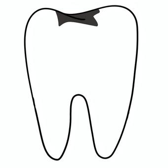 Illustration, a denture, tooth, back teeth, 
