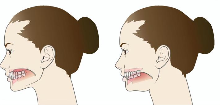 正しい舌の位置と悪い舌の位置 舌,位置,スポット,口蓋,二重あご,前歯,女性,横顔,正しい,悪いのイラスト素材