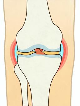 前十字靭帯（輪郭あり） 前十字靭帯,後十字靭帯,膝,右膝,関節,軟骨,半月板,大腿骨,脛骨,腓骨のイラスト素材