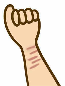 リストカット リストカット リストカット,傷跡,手首,手,腕,キズ,リスカ,自傷行為,傷つけるのイラスト素材