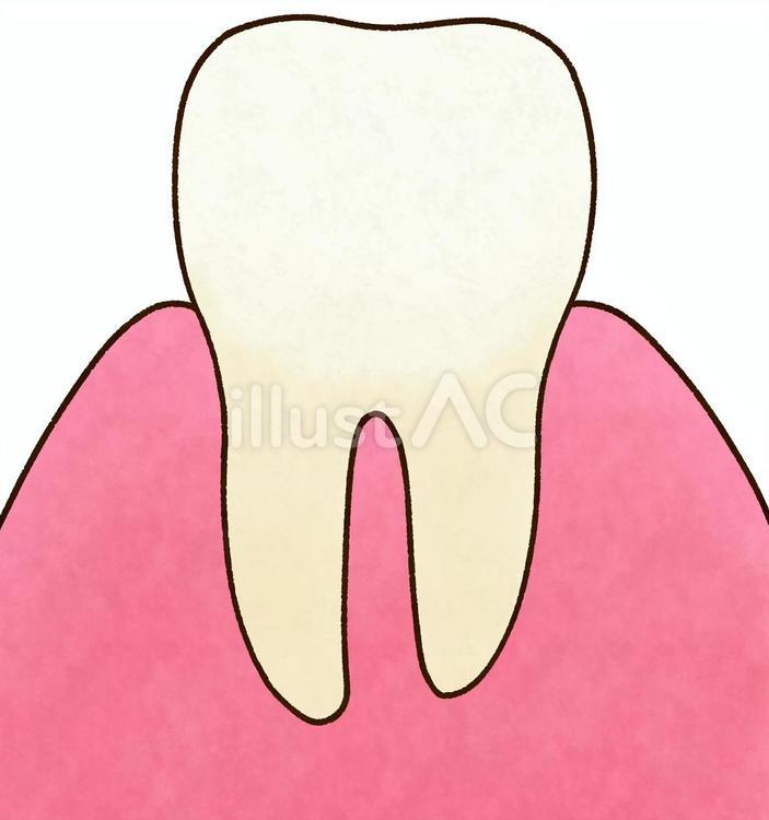 歯茎に埋まった歯 歯,エナメル質,歯冠のイラスト素材