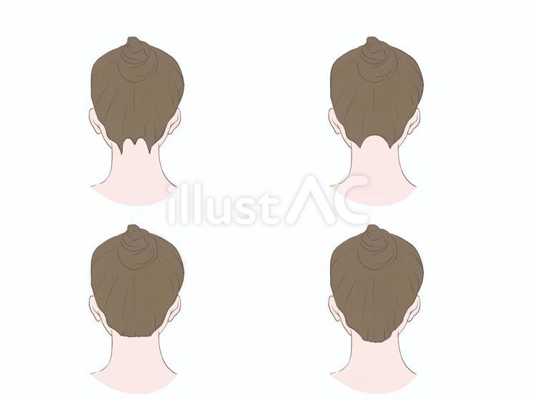 女性のうなじ　タイプ別　文字無し 脱毛,除毛,女性のイラスト素材