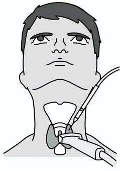 甲状腺にエコーしながら針を刺す　白黒 甲状腺,針,エコー,男性,白黒のイラスト素材