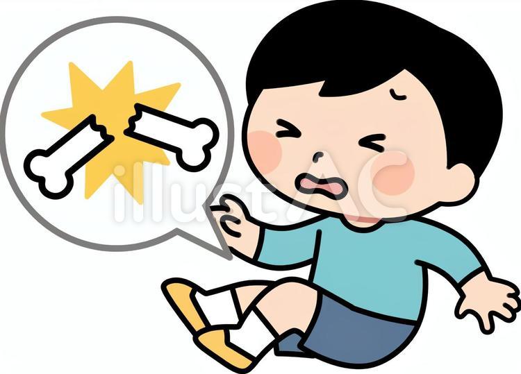 骨折する男の子 人物,子供,男の子のイラスト素材