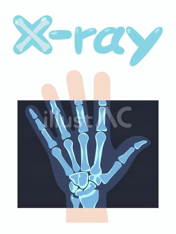 Xで始まる英単語　X-ray 英単語,x線,レントゲンのイラスト素材