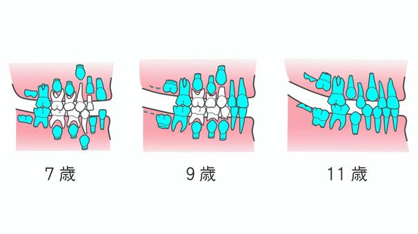 生え変わり_7～11歳 乳歯,永久歯,生え変わり,歯,歯科,矯正,7歳,9歳,11歳,混合歯列のイラスト素材