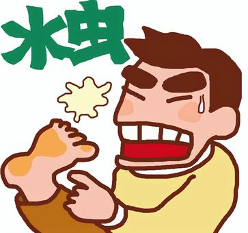 水虫になる男性 水虫,治療,健康,男性,痒いのイラスト素材