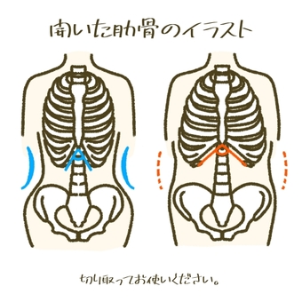 開いた肋骨のイラスト　リブフレア 肋骨,リブフレア,姿勢,健康,美容,鍼灸院,接骨院,骨格矯正,骨盤矯正,姿勢改善のイラスト素材