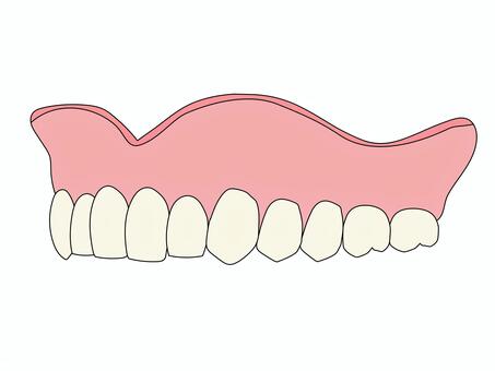 上顎総義歯 斜め45度（主線あり） フルデンチャー,総義歯,入れ歯,上顎義歯,歯科技工,歯科技工士,歯科,医療,教材用イラスト,vectorのイラスト素材
