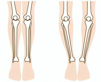 O脚の骨格正面 o脚,脚,足,骨格,正面,まっすぐ,美脚,整体のイラスト素材