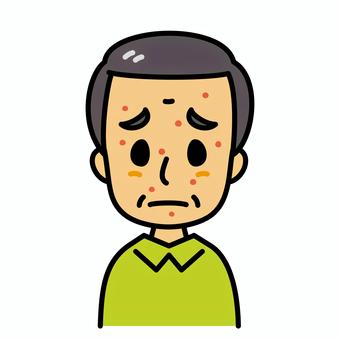 シニア男性　発疹 発疹,高齢者,湿疹,水疱瘡,病気,症状,皮膚疾患,アレルギー,麻疹,水疱のイラスト素材