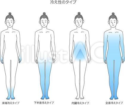 冷え症のタイプ