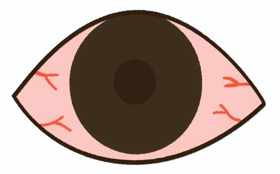 真っ赤に充血したシンプルな目玉 赤目,目,花粉症,充血,目玉,赤い,ドライアイ,結膜炎,アレルギー,感染症のイラスト素材