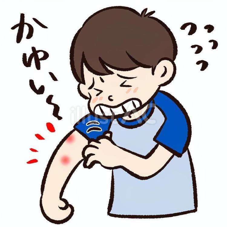 虫刺され・発疹でかゆい男の子 虫刺され,かゆい,かゆみのイラスト素材
