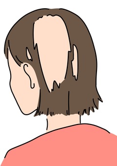 Illustration, careca, alopecia, doença, 
