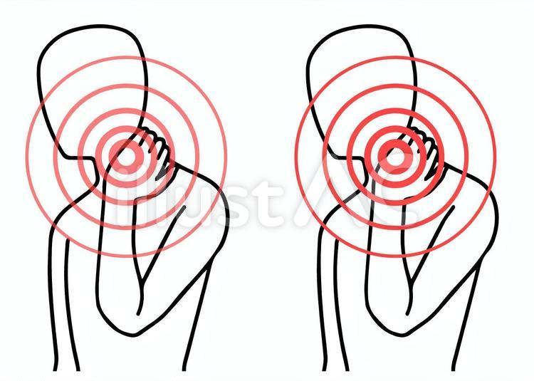 首の痛み、肩こり、人型、同心円 首,こり,肩のイラスト素材