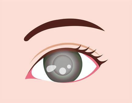 目の病気イラスト / 緑内障 眼,目,緑内障,病気,目玉,眼球,ヘルスケア,顔,医療,病院のイラスト素材