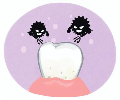 歯の汚れとバイ菌のイラスト【紫背景】 歯,虫歯,磨き残し,ばい菌,口内環境,歯茎,汚れ,イラスト,カットイラスト,口内のイラスト素材