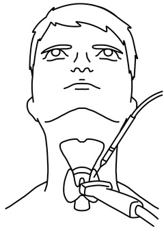 甲状腺にエコーしながら針を刺す　線画 甲状腺,エコー,針,男性,線画のイラスト素材