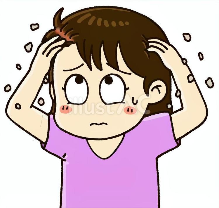 脂漏性湿疹で頭が痒い女性 頭皮,フケ,皮膚のイラスト素材