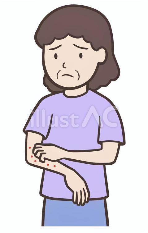 皮膚のかゆみで腕を掻く中年女性 掻く,肌,痒いのイラスト素材