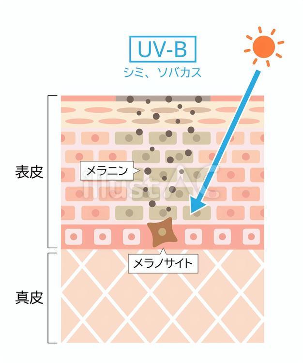 紫外線　UV-B　肌の断面図 紫外線,uv-b,肌のイラスト素材