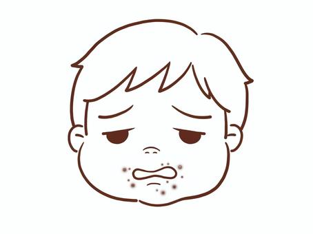 手足口病の男の子(色なし) 男の子,男児,子供,幼稚園児,小学生,顔,困る,アレルギー,可愛い,白背景のイラスト素材