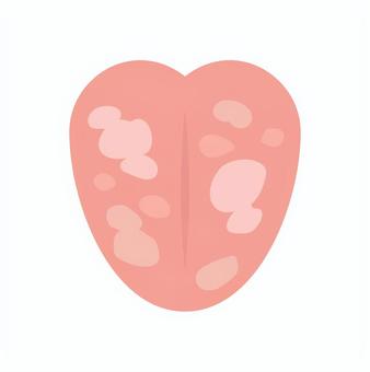 まだら舌 舌,ベロ,口腔,口内,歯科,口腔外科,口臭,オーラルケア,まだら,病状のイラスト素材