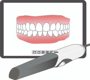 口腔内スキャナー 歯科,スキャナー,３ｄ,口腔内,印象採得,デジタル,モニター,歯科用,光学印象,オーラルスキャナーのイラスト素材