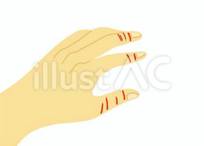 指先にあかぎれが沢山出来ている主線なし