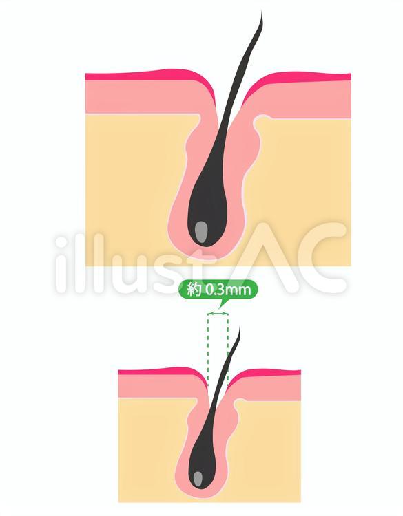 皮膚の毛穴のイラスト 皮膚の毛穴,毛穴,皮膚のイラスト素材
