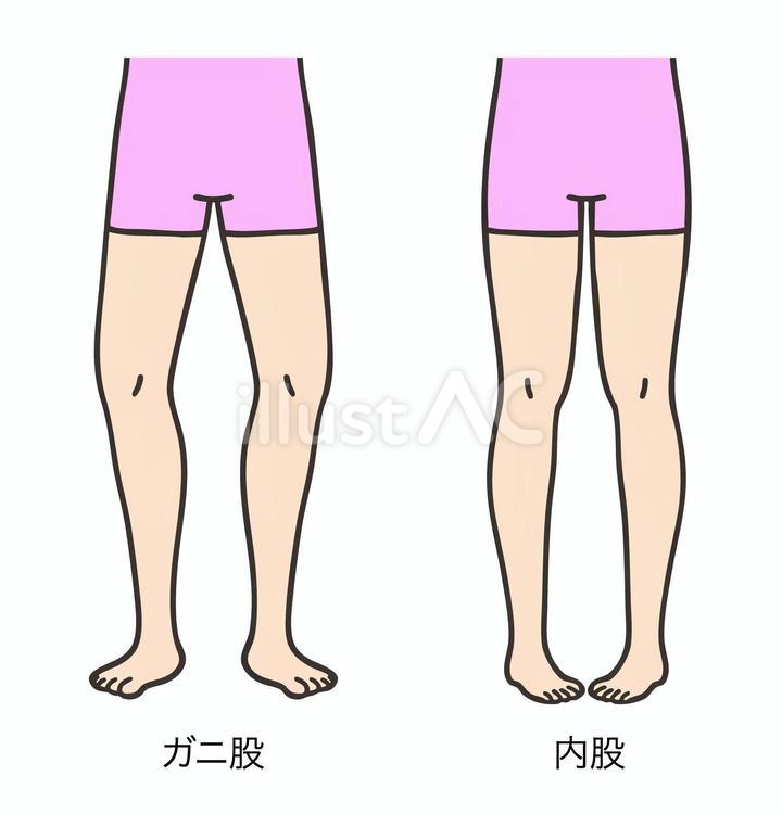 ガニ股と内股 ガニ股,内股,下肢のイラスト素材