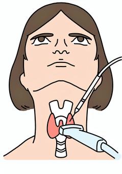 甲状腺にエコーしながら針　女性カラー 甲状腺,女性,針,エコー,検査,カラーのイラスト素材