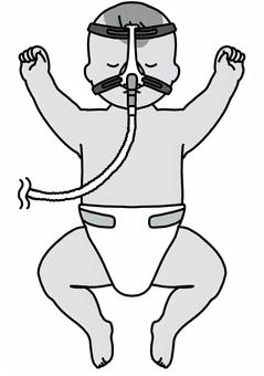 CPAPをつけた赤ちゃん　白黒