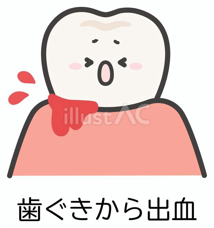 歯茎から出血する歯のイラスト06-8 歯,出血,歯槽膿漏のイラスト素材