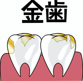 金歯　 金歯,治療,詰め物,口内,歯茎,健康,イメージ,漢字,線画のイラスト素材