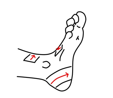 ヒールロック ヒールロック,テーピング,固定,足首捻挫,前距腓靭帯のイラスト素材