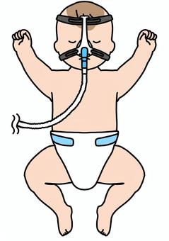 CPAPをつけた赤ちゃん　カラー