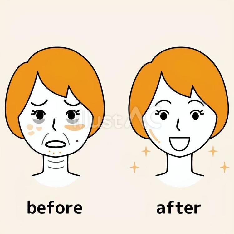 美容整形前後の女性 女性,整形,beforeのイラスト素材