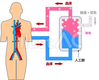 人工肺