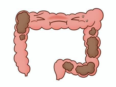 便秘の大腸(カラー) 内臓,臓器,大腸,腸,腸活,腸内,医療,手がき,シンプル,フリーハンドのイラスト素材