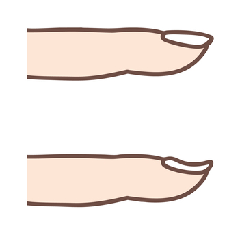 Illustration, claw, normal, spoon claw, 
