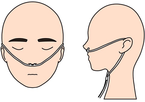 経鼻酸素チューブ 横顔と正面カラー 経鼻酸素チューブ 横顔と正面カラー 経鼻,酸素,チューブ,横顔,正面,カラーのイラスト素材